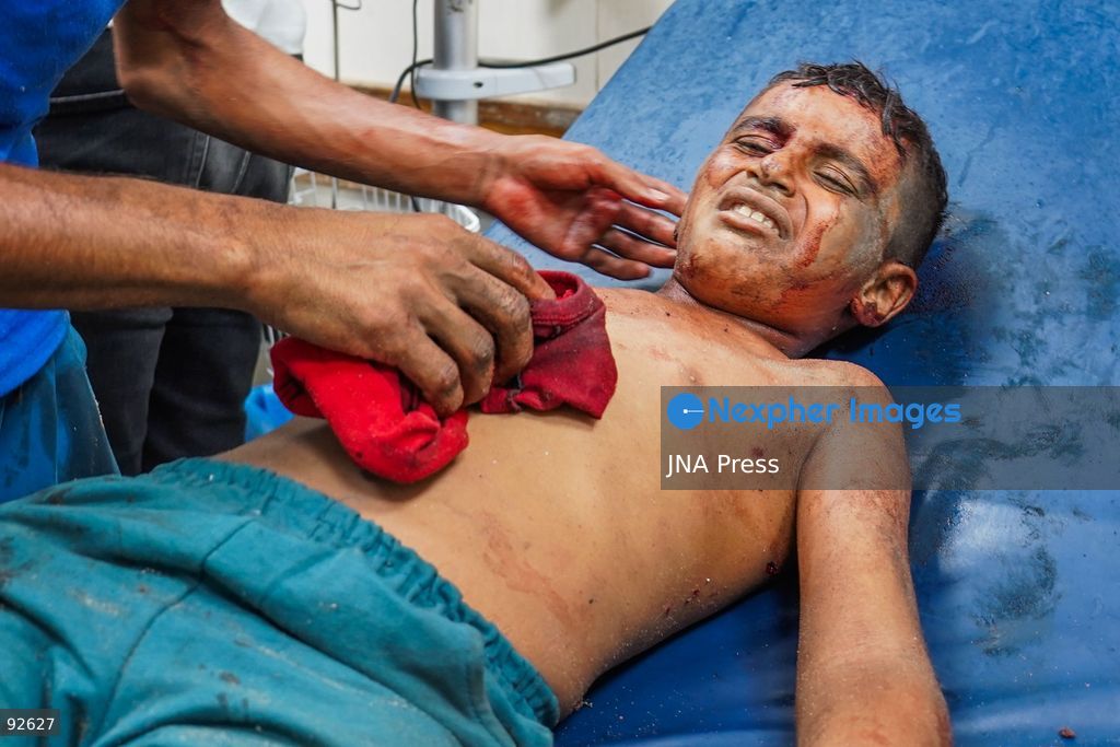 KHAN YOUNIS, GAZA STRIP, PALESTINE, SEPTEMBER 15, 2026: The bodies of two Palestinians and a number of wounded people, including children, arrive at Nasser Medical Complex following a reported Israeli strike on tents housing displaced Palestinians at Al-Sumoud camp west of Khan Younis in the southern Gaza Strip. Photo by Ramzi Abu Amer / JNA Press. (Photo by Ramzi Abu Amer/JNA Press via Nexpher Images)